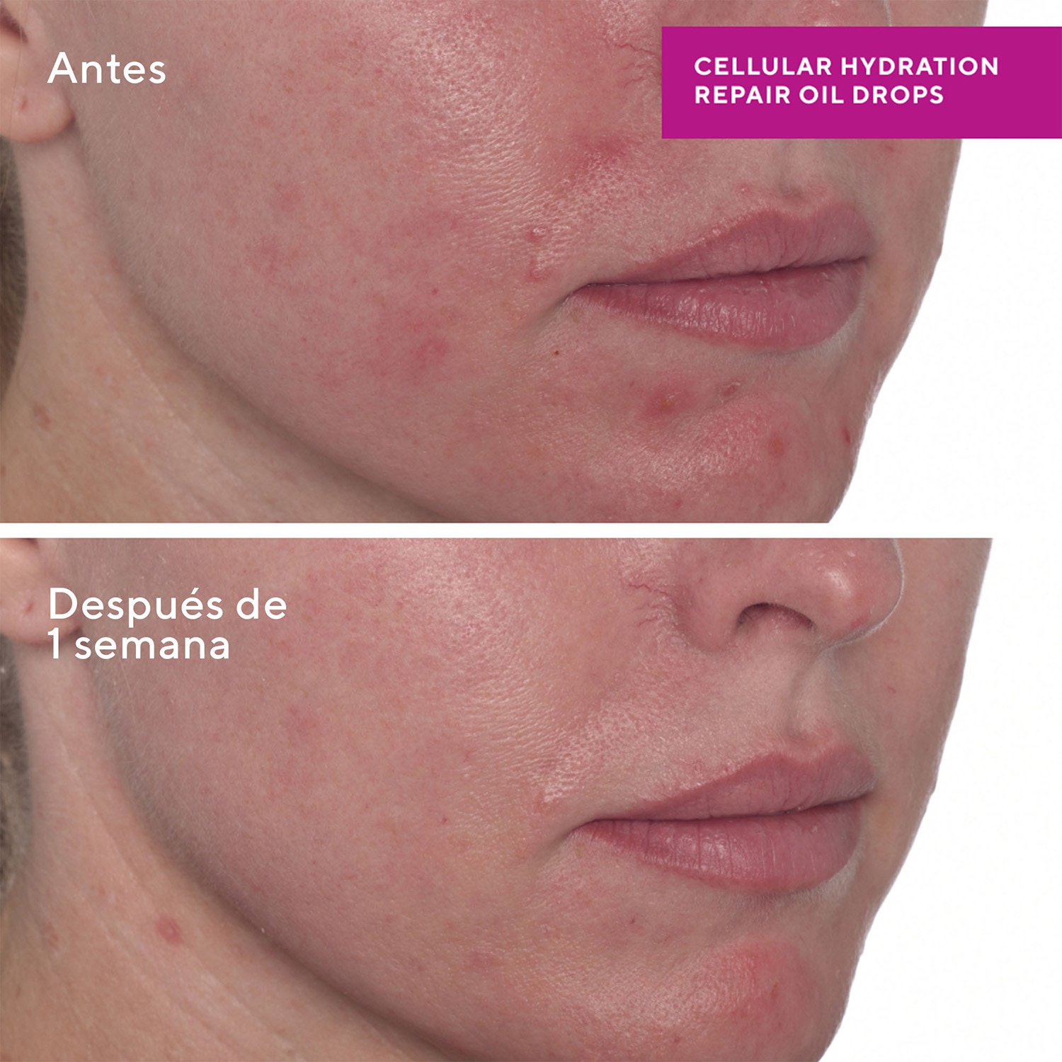 CELLULAR HYDRATION REPAIR OIL DROPS (HIDRATANTE FACIAL)